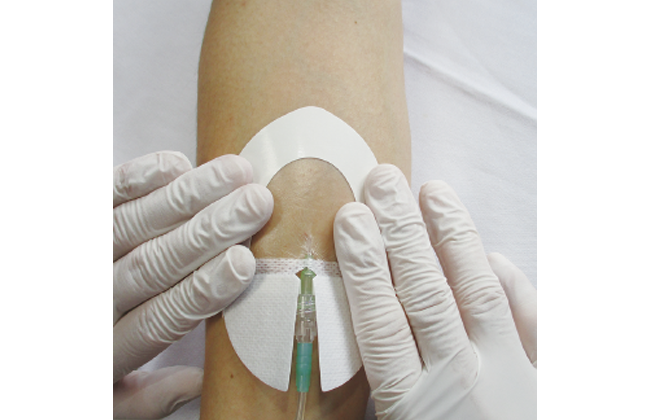 末梢静脈カテーテル固定フィルムのわかりやすい貼り方【エアウォールIV　切り込みタイプ】の画像